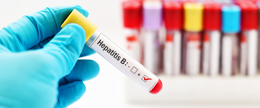 Hepatitis B ni nini? Dalili na njia za matibabu ni nini?